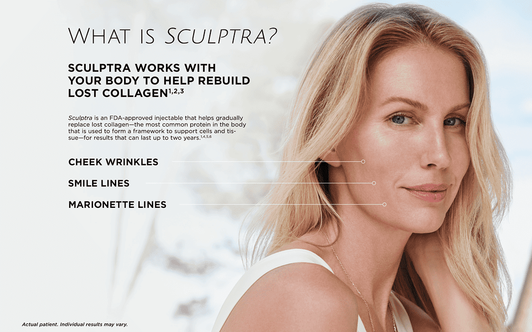 The Natural Appeal of Sculptra®