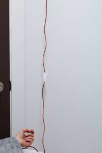 Iron infusion administered intravenously in a clinical setting.