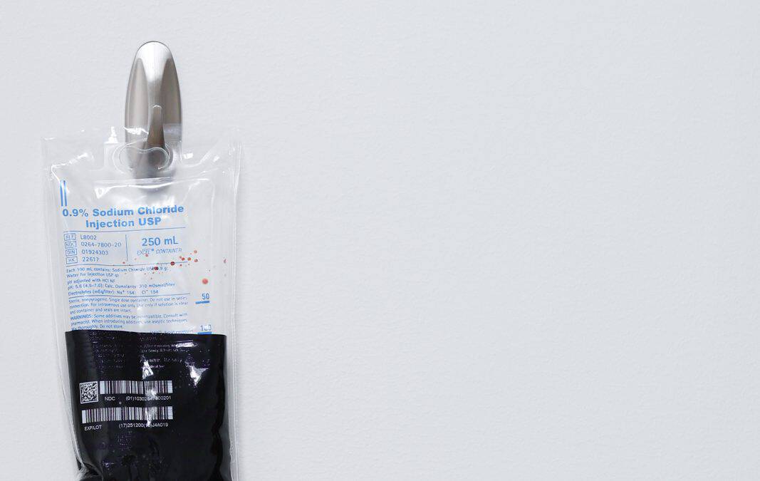 Kamloops iron infusions IV bag at Dr. Kaleb Falk ND clinic